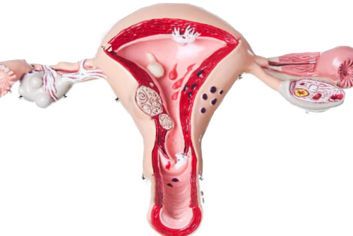 Causes of infertility